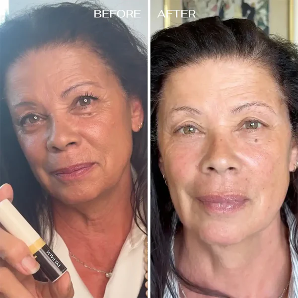 ALL-IN-ONE BALM FOR UNDER-EYE RENEWAL - Image 2