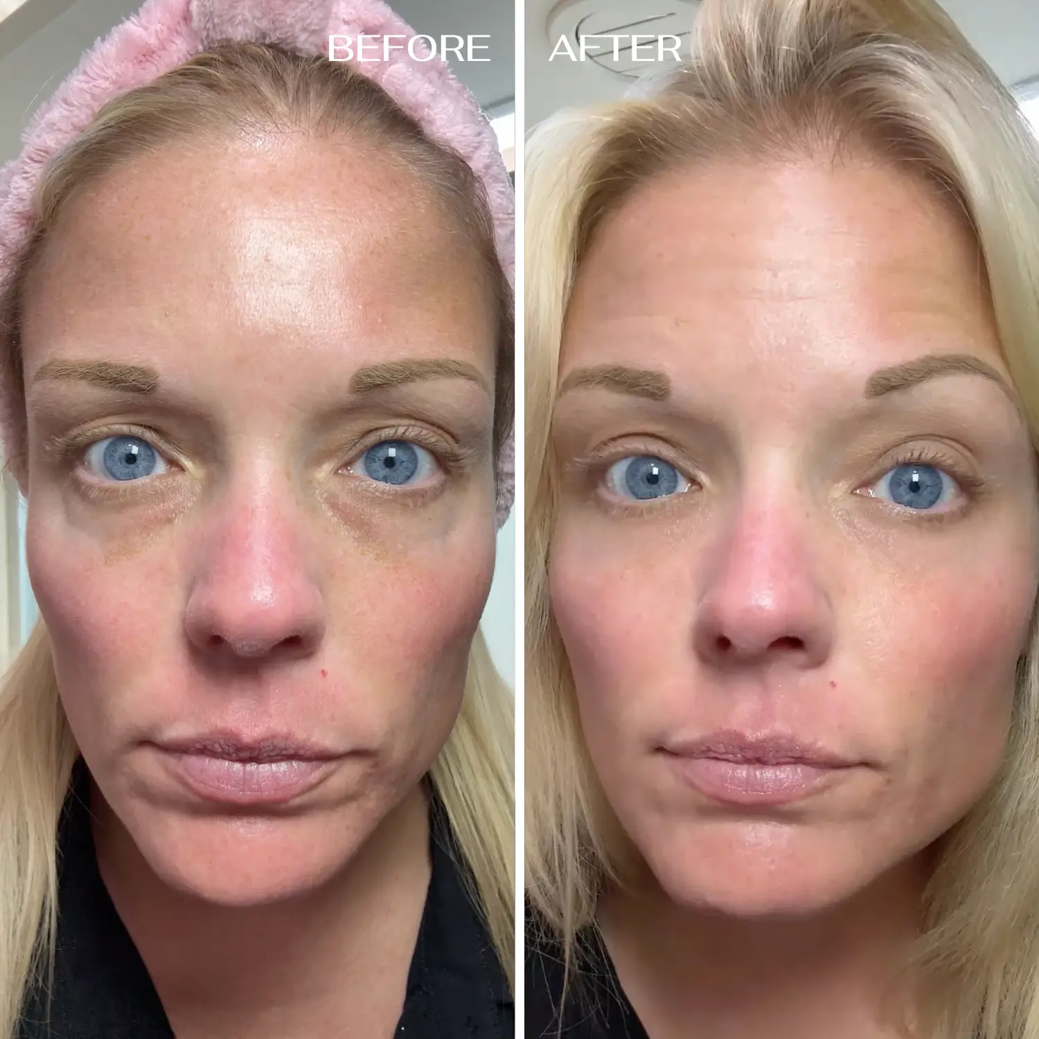 ALL-IN-ONE BALM FOR UNDER-EYE RENEWAL - Image 7
