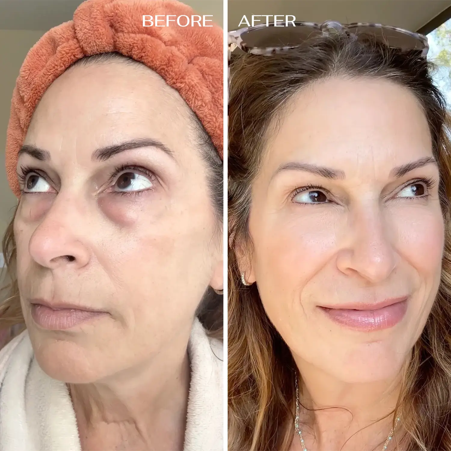 ALL-IN-ONE BALM FOR UNDER-EYE RENEWAL - Image 8