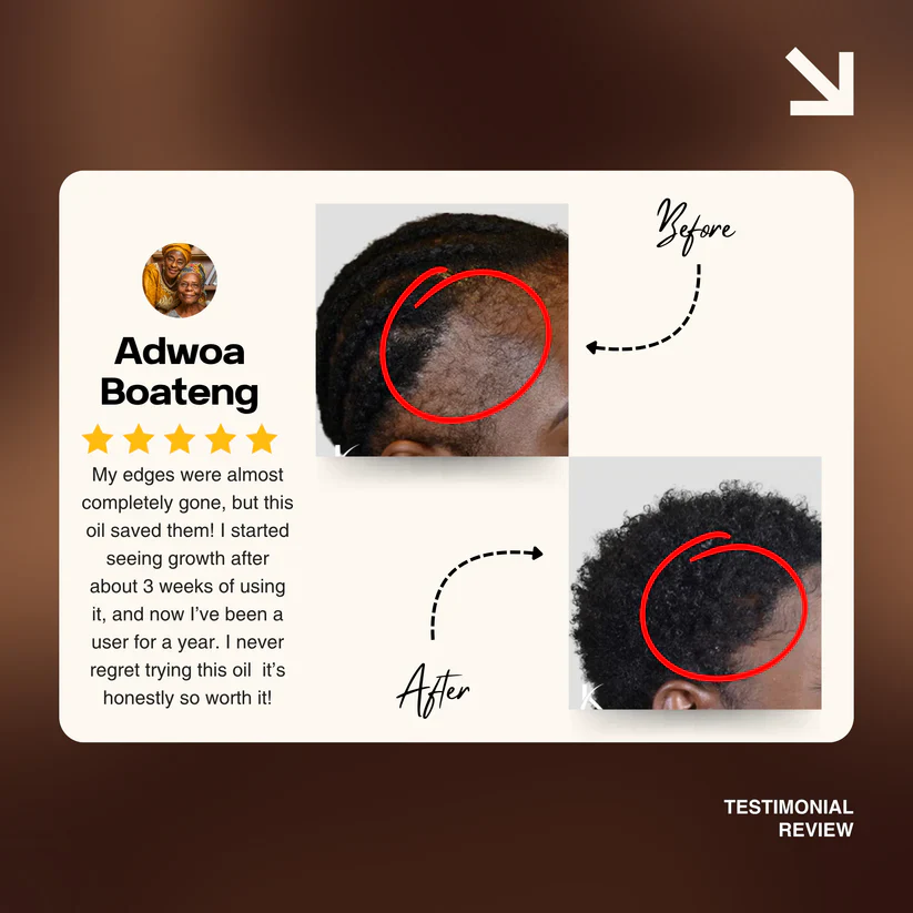 Batana Natural Hair Growth Oil 2.0 - Image 8