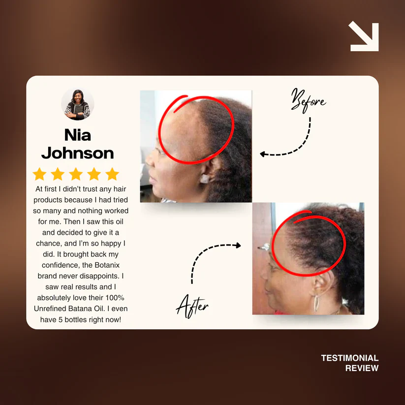 Batana Natural Hair Growth Oil 2.0 - Image 9