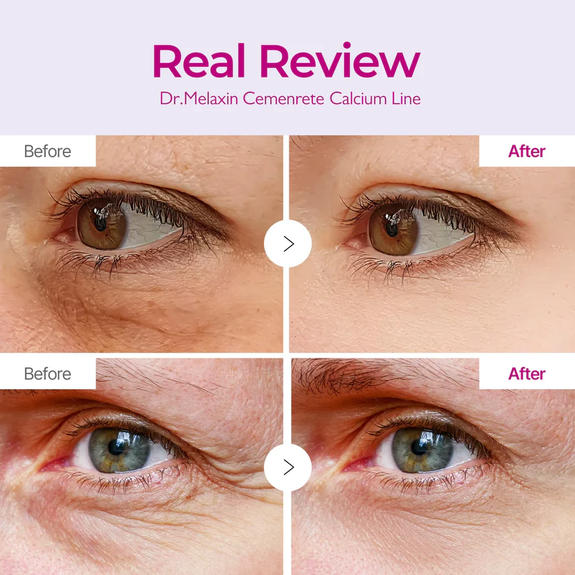 Calcium Volume Multi Balm+Eye Patch 60ea | Anti-Aging Skincare - Image 10