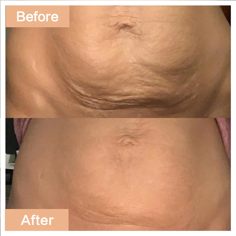 Age-Defying Revival Collagen & Stem Cell Body Oil - Image 8