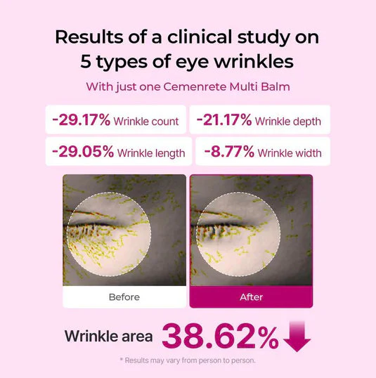 Transform Wrinkles, Fine Lines, And Tired Creases Naturally - Image 8