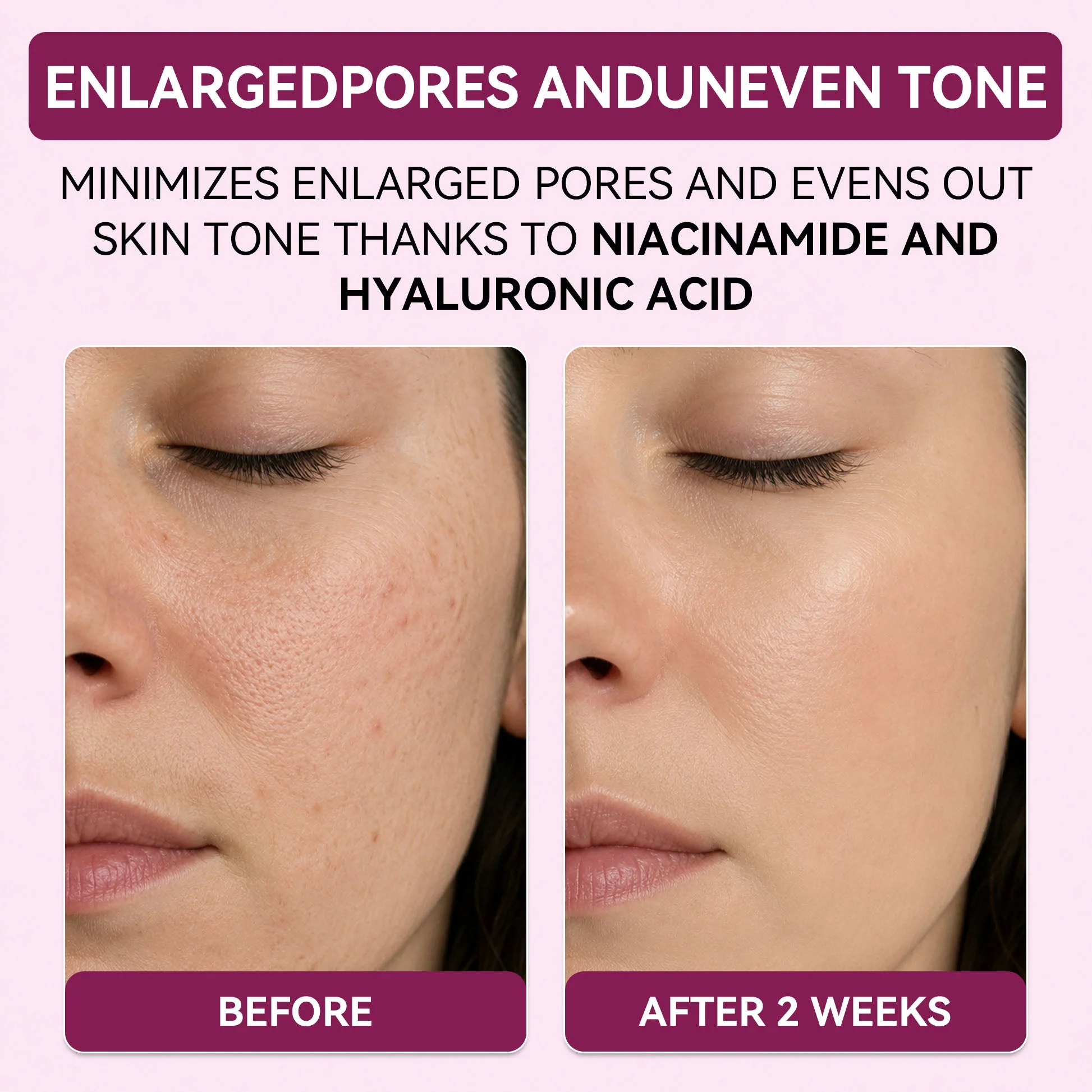 Regenerating Mask with Hydrolyzed Collagen and Niacinamide - Image 4