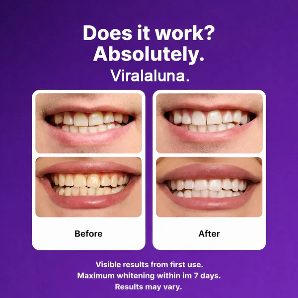 Viralaluna™ Color-Correct Whitening Strips - Image 3