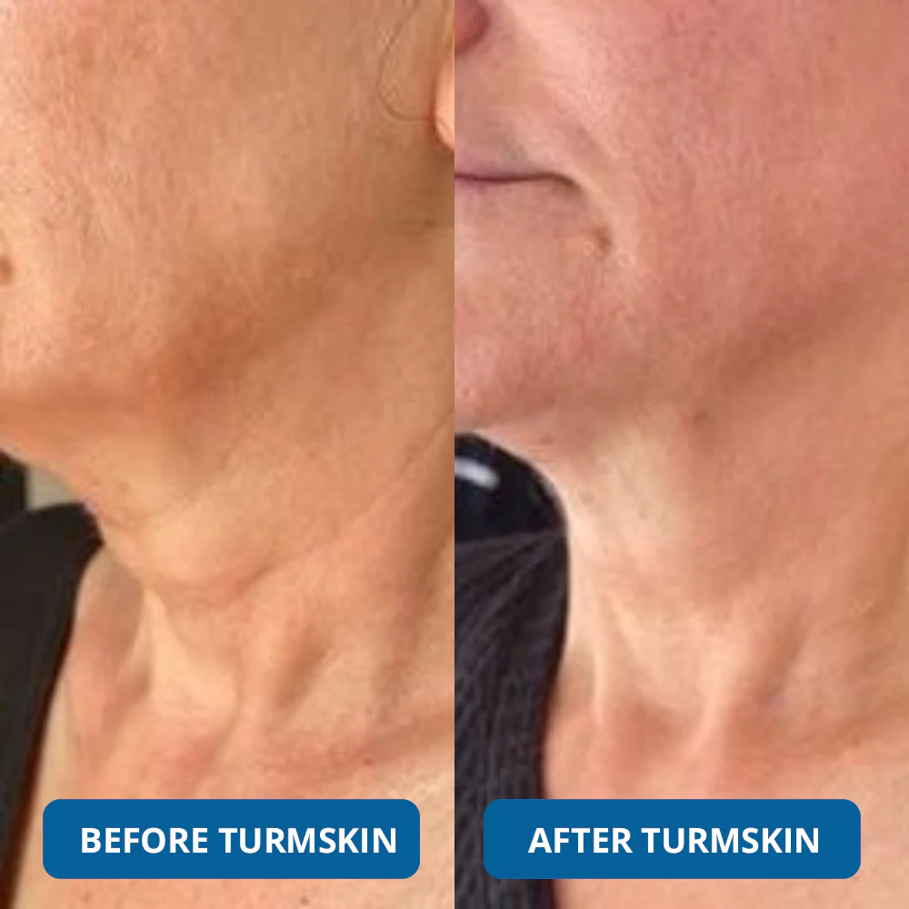 3% Hyaluronic Acid Ultra Hydrating Serum - Image 5