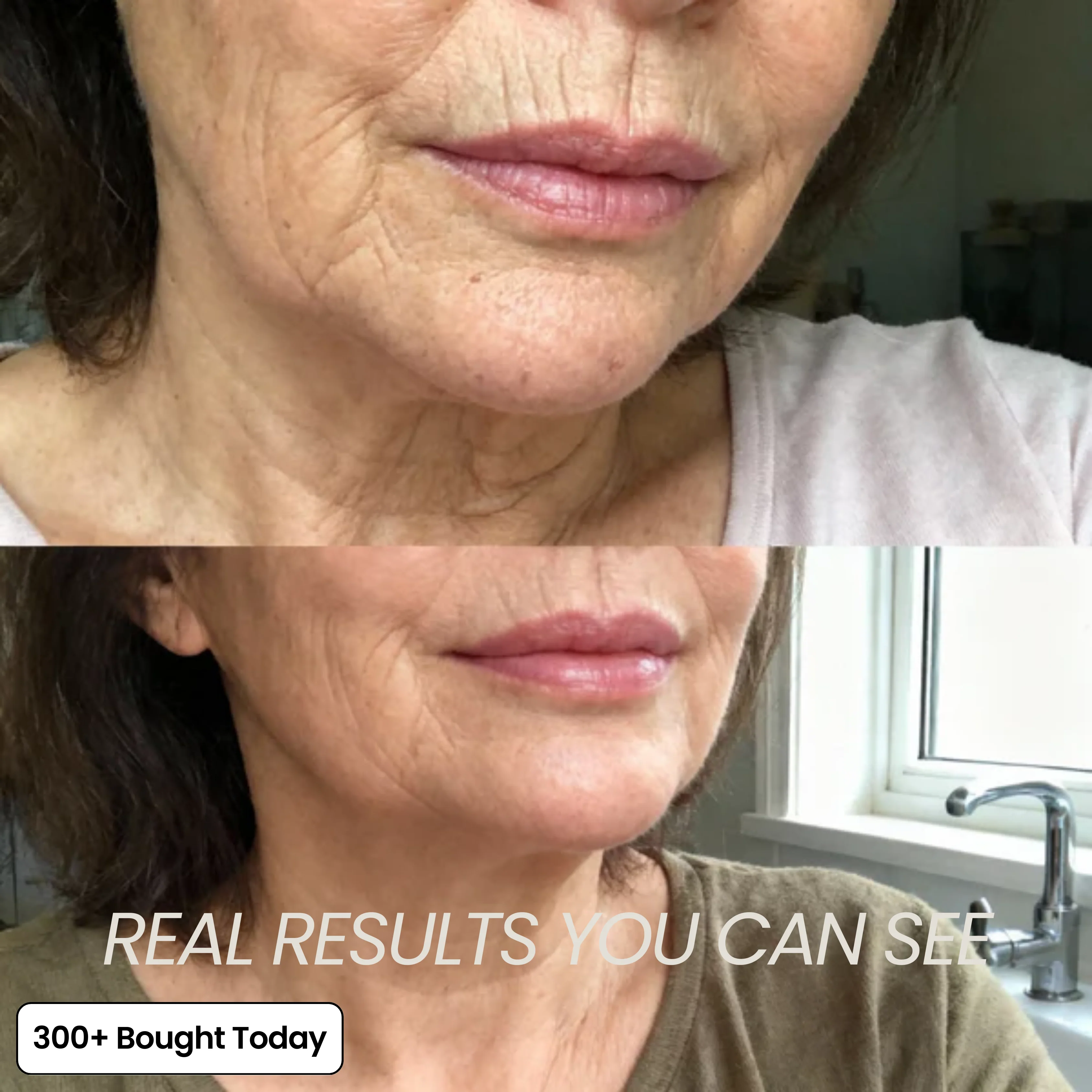 Transform Wrinkles, Fine Lines, And Tired Creases Naturally - Image 4