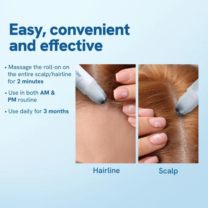 Advanced Hair Growth Roll-On Serum - Image 7