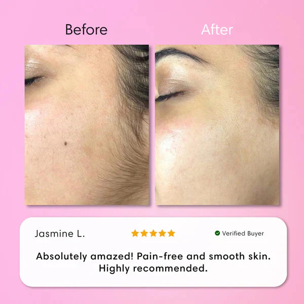 Hair Removal Kit - Image 4