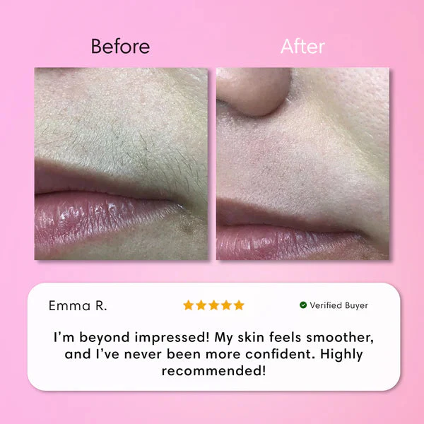 Hair Removal Kit - Image 5