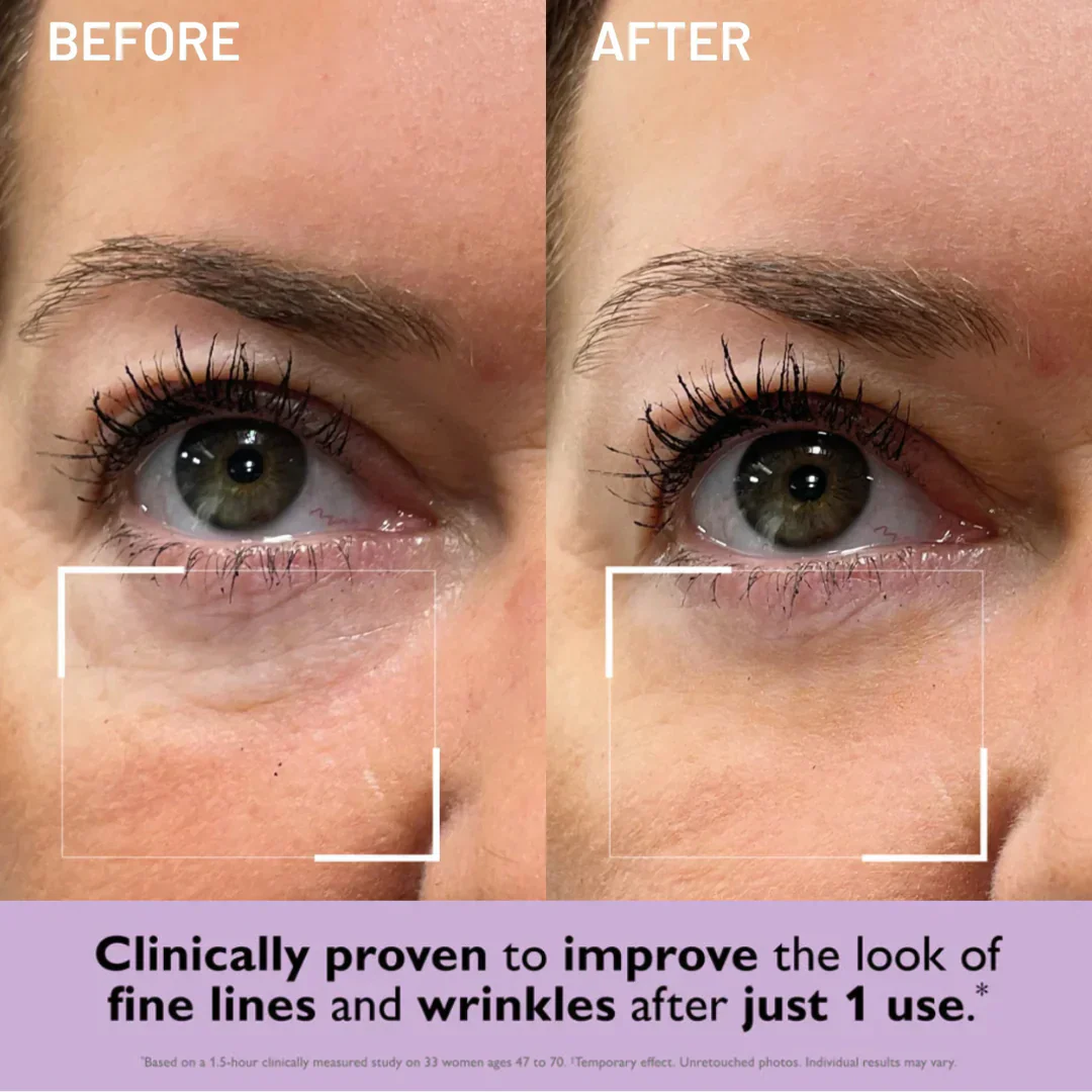 Collagen Infusion Tightening Eye Patches - Image 3