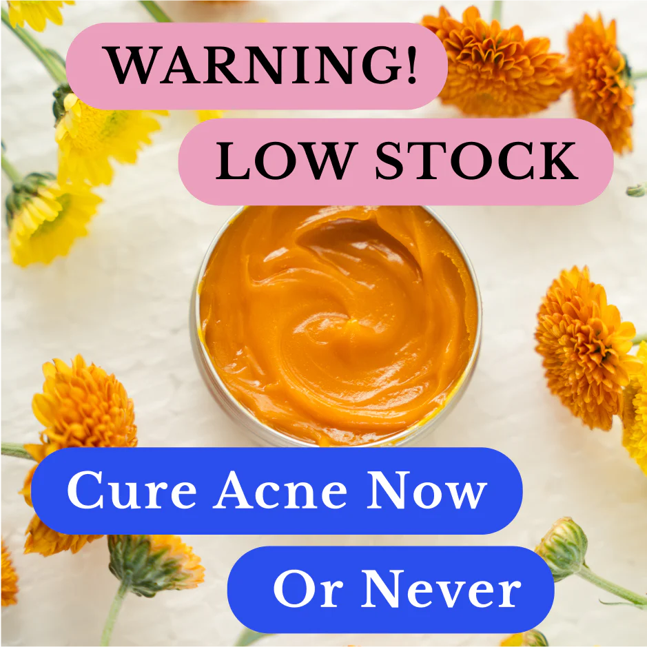 Kill Acne & Redness Ritual - Image 13