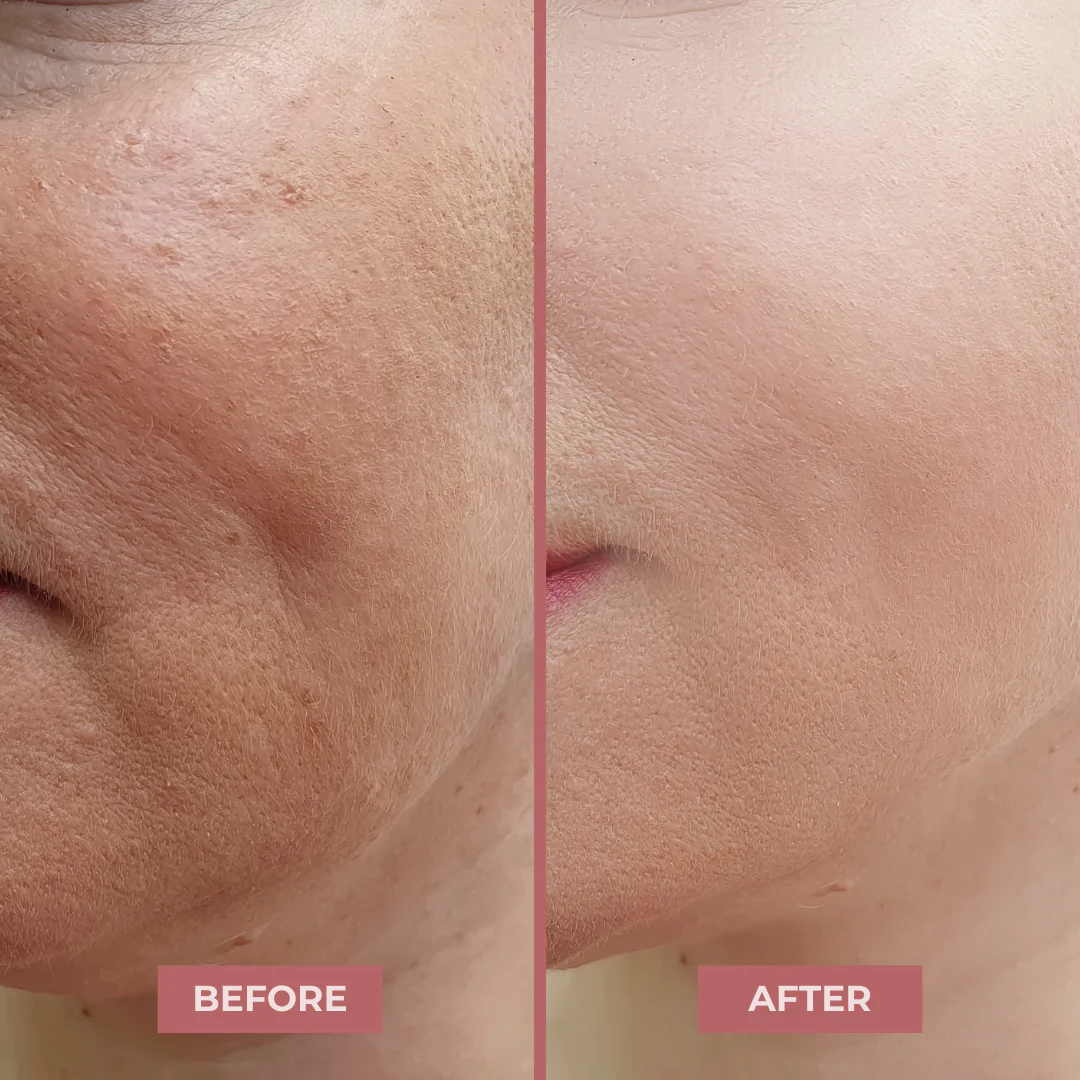 NAD+ Peptide Boosting Serum - Image 7