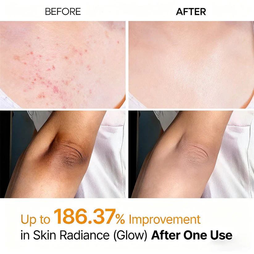 Viralaluna Peel Shot - Kojic + Turmeric Body Peel Spray - Image 7