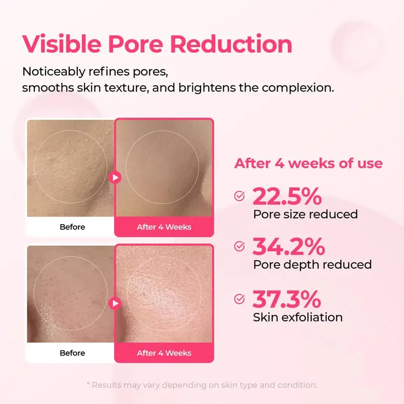 Pore & Spot Care Duo - Image 4
