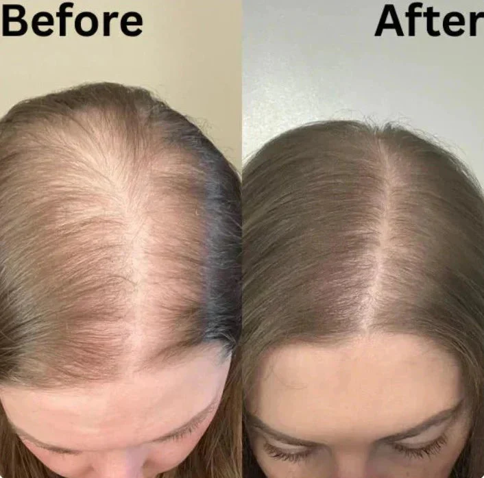 Rosemary Foaming Shampoo - Image 6