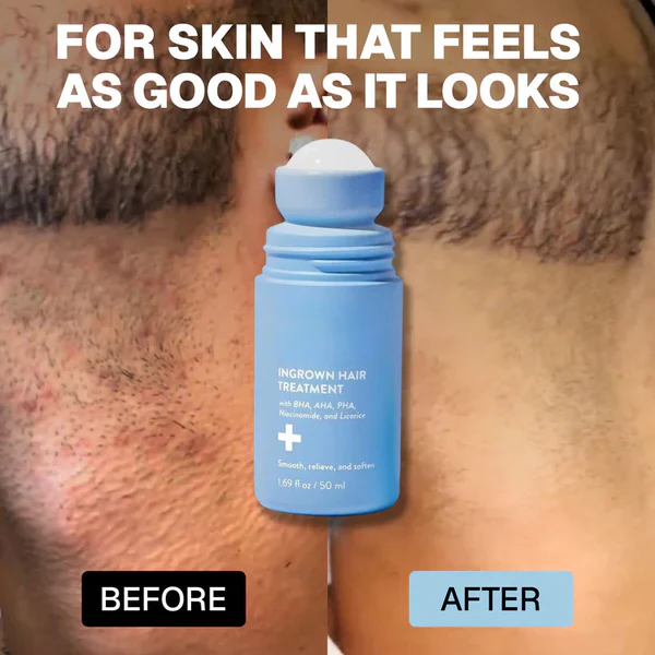 Viralaluna: Smoothing Solution For Ingrown Hairs - Image 6