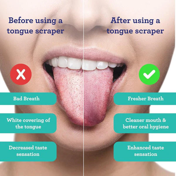 Tongue scraper - Image 3
