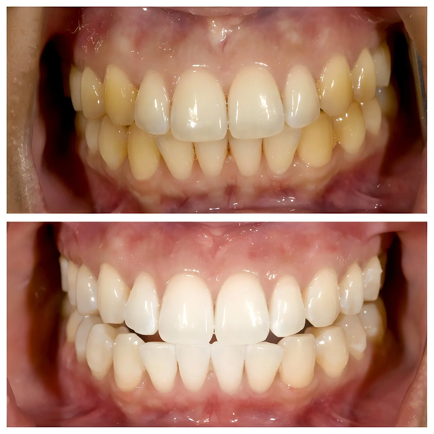 Viralaluna-ToothPaste - Image 9