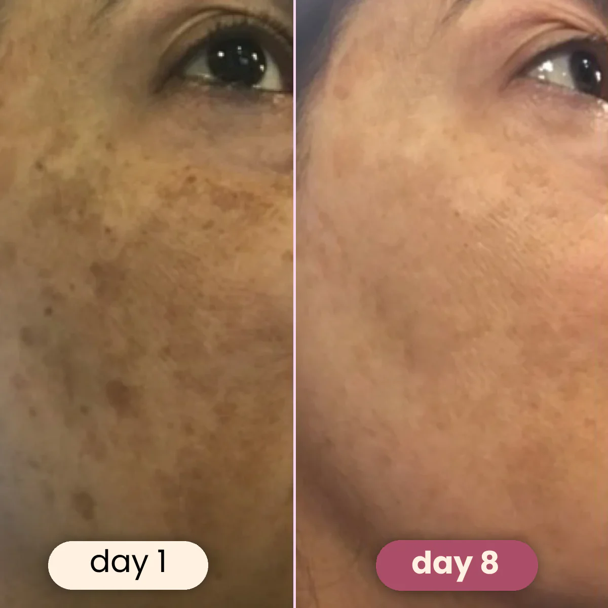 Brightening turmeric & kojic acid pads - Image 10