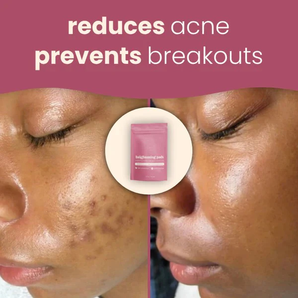 Brightening turmeric & kojic acid pads - Image 5