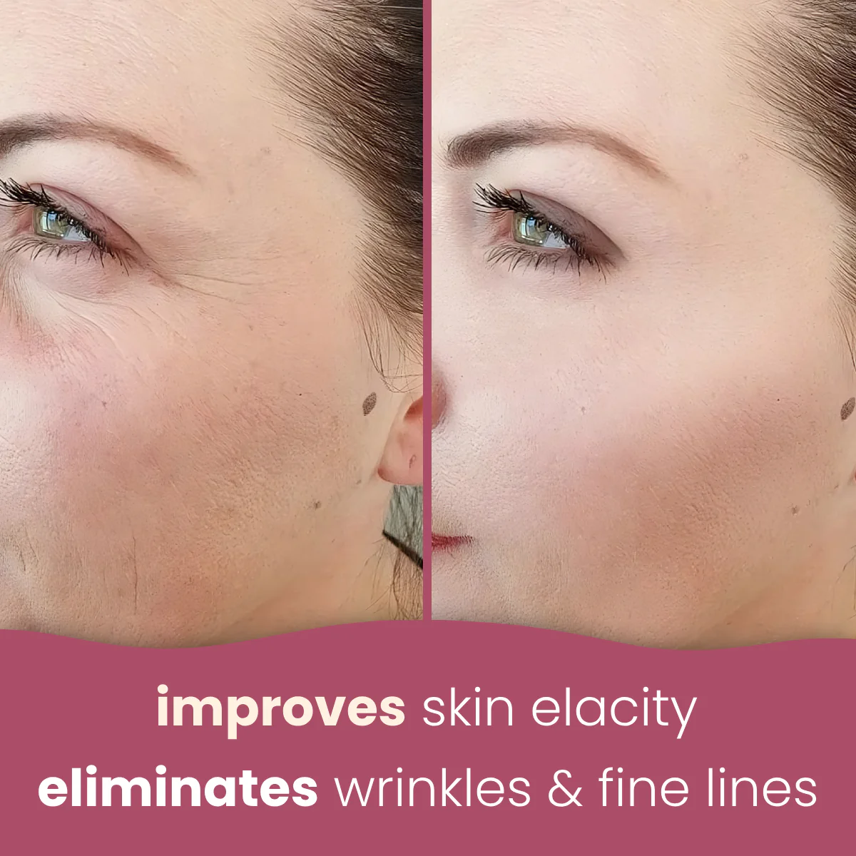 Brightening turmeric & kojic acid pads - Image 6
