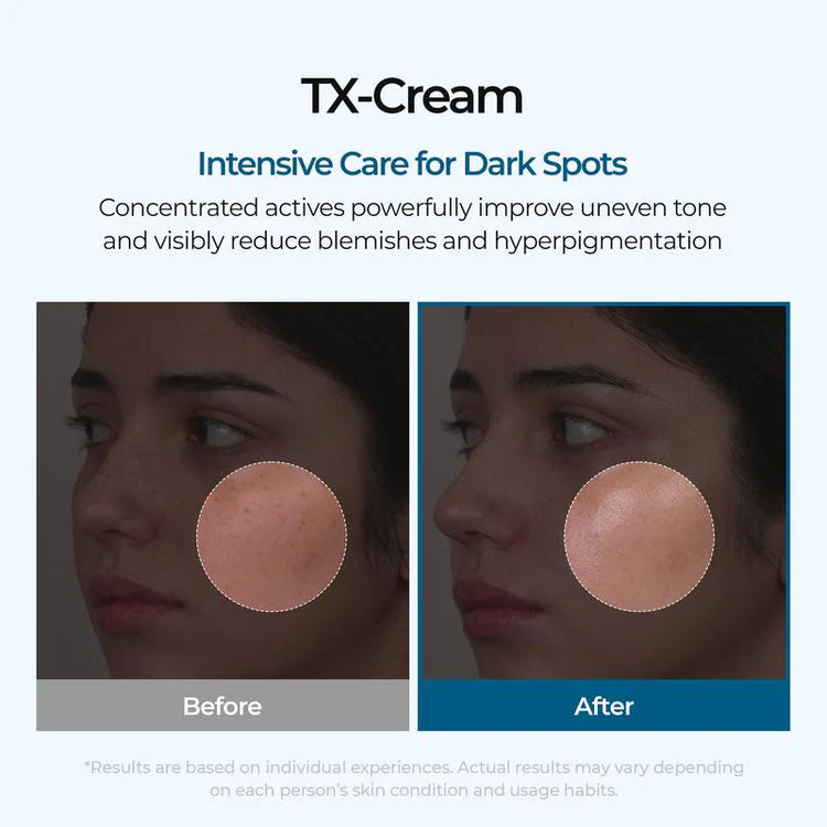 TX Cream – Dark Spot & Hyperpigmentation Corrector - Image 2