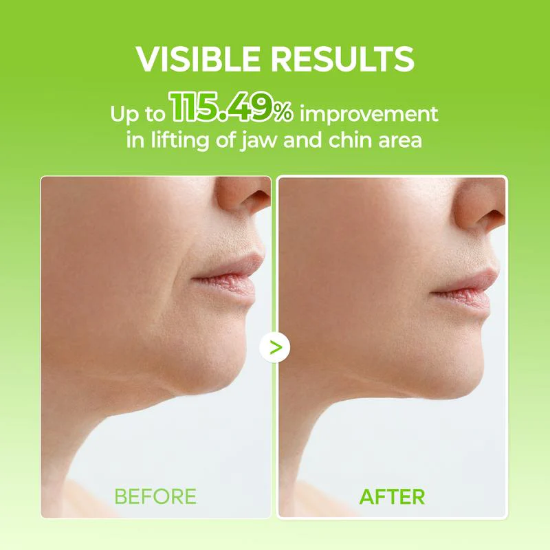 Cactox V-Lifting Mewing Band (4x Masks Per Pack) - Image 6