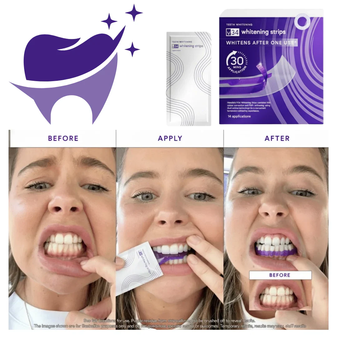 SmileV34™Whitening Strips: ‘’The Fast Track to a Stunning Smile!‘’ - Image 7