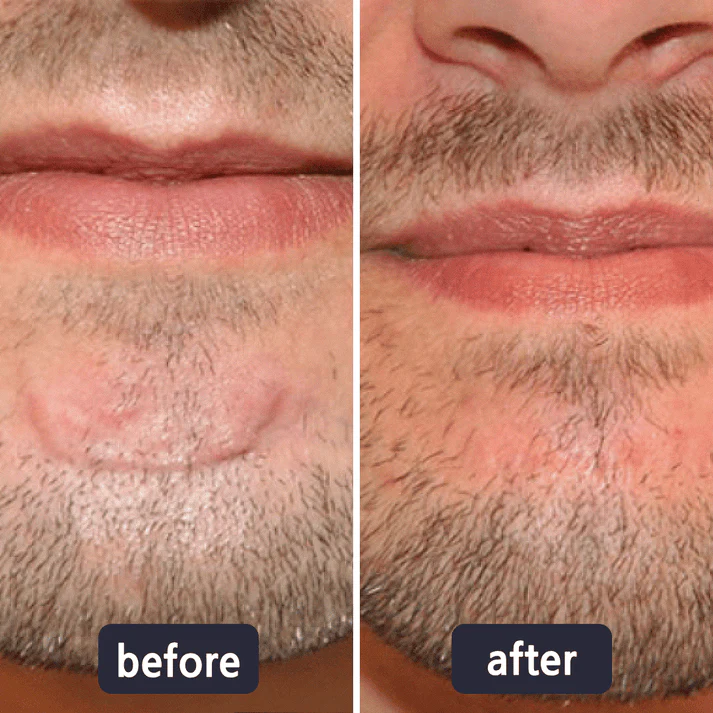 Viralaluna Scar Removal Cream - Image 6