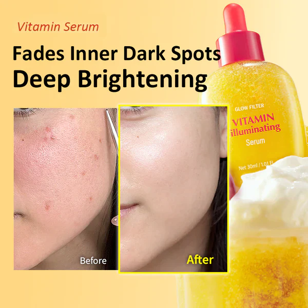 [#1 Solution for Dark Skin] Vitamin Illuminating Serum - Image 4